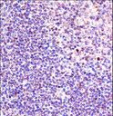 PHAP1 / ANP32A Antibody - ANP32A Antibody immunohistochemistry of formalin-fixed and paraffin-embedded human tonsil tissue followed by peroxidase-conjugated secondary antibody and DAB staining.