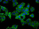 PHEX / PEX Antibody - Immunofluorescence staining of HepG2 cells diluted at 1:133, counter-stained with DAPI. The cells were fixed in 4% formaldehyde, permeabilized using 0.2% Triton X-100 and blocked in 10% normal Goat Serum. The cells were then incubated with the antibody overnight at 4°C.The Secondary antibody was Alexa Fluor 488-congugated AffiniPure Goat Anti-Rabbit IgG (H+L).