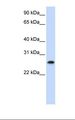 PHF19 Antibody - Jurkat cell lysate. Antibody concentration: 1.0 ug/ml. Gel concentration: 12%.  This image was taken for the unconjugated form of this product. Other forms have not been tested.