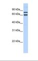 PHF20L1 Antibody - 721_B ell lysate. Antibody concentration: 1.0 ug/ml. Gel concentration: 12%.  This image was taken for the unconjugated form of this product. Other forms have not been tested.