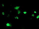 PHF21B Antibody - Anti-PHF21B mouse monoclonal antibody immunofluorescent staining of COS7 cells transiently transfected by pCMV6-ENTRY PHF21B.