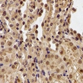 PHF21B Antibody - Immunohistochemical analysis of PHF21B staining in human kidney formalin fixed paraffin embedded tissue section. The section was pre-treated using heat mediated antigen retrieval with sodium citrate buffer (pH 6.0). The section was then incubated with the antibody at room temperature and detected using an HRP conjugated compact polymer system. DAB was used as the chromogen. The section was then counterstained with hematoxylin and mounted with DPX.