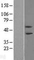 PHF21B Protein - Western validation with an anti-DDK antibody * L: Control HEK293 lysate R: Over-expression lysate