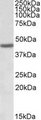 PHF9 / FANCL Antibody - FANCL antibody (1 ug/ml) staining of Human Bone Marrow lysate (35 ug protein/ml in RIPA buffer). Primary incubation was 1 hour. Detected by chemiluminescence.