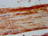 PHKA1 Antibody - Immunohistochemistry Dilution at 1:500 and staining in paraffin-embedded human skeletal muscle tissue performed on a Leica BondTM system. After dewaxing and hydration, antigen retrieval was mediated by high pressure in a citrate buffer (pH 6.0). Section was blocked with 10% normal Goat serum 30min at RT. Then primary antibody (1% BSA) was incubated at 4°C overnight. The primary is detected by a biotinylated Secondary antibody and visualized using an HRP conjugated SP system.