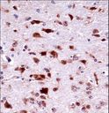 PHKG2 Antibody - Mouse Phkg2 Antibody immunohistochemistry of formalin-fixed and paraffin-embedded mouse brain tissue followed by peroxidase-conjugated secondary antibody and DAB staining.