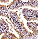 PHLDA2 / TSSC3 Antibody - PHLDA2 Antibody immunohistochemistry of formalin-fixed and paraffin-embedded human prostate tissue followed by peroxidase-conjugated secondary antibody and DAB staining.