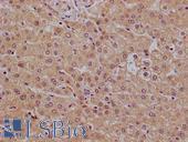 PHLDA3 Antibody - Human, liver: Formalin-Fixed, Paraffin-Embedded (FFPE)