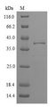 Pollen allergen Phl p 5b Protein - (Tris-Glycine gel) Discontinuous SDS-PAGE (reduced) with 5% enrichment gel and 15% separation gel.