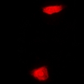PHYHD1 Antibody - Immunofluorescent analysis of PHYHD1 staining in MCF7 cells. Formalin-fixed cells were permeabilized with 0.1% Triton X-100 in TBS for 5-10 minutes and blocked with 3% BSA-PBS for 30 minutes at room temperature. Cells were probed with the primary antibody in 3% BSA-PBS and incubated overnight at 4 deg C in a humidified chamber. Cells were washed with PBST and incubated with a DyLight 594-conjugated secondary antibody (red) in PBS at room temperature in the dark.