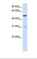 PHYKPL / AGXT2L2 Antibody - Fetal liver lysate. Antibody concentration: 1.0 ug/ml. Gel concentration: 12%.  This image was taken for the unconjugated form of this product. Other forms have not been tested.