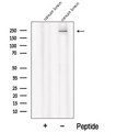 PI4KA Antibody - Western blot analysis of extracts of mouse brain tissue using PI4KA antibody. The lane on the left was treated with blocking peptide.