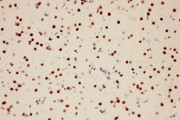 PIAS1 Antibody - PIAS1 antibody. IHC(P): Rat Brain Tissue.