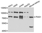 PIAS1 Antibody - Western blot analysis of extracts of various cell lines, using PIAS1 antibody at 1:1000 dilution. The secondary antibody used was an HRP Goat Anti-Rabbit IgG (H+L) at 1:10000 dilution. Lysates were loaded 25ug per lane and 3% nonfat dry milk in TBST was used for blocking. An ECL Kit was used for detection and the exposure time was 90s.