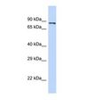 PIEZO2 / FAM38B Antibody - Western blot of Human 293T. PIEZO2 antibody dilution 1.0 ug/ml.  This image was taken for the unconjugated form of this product. Other forms have not been tested.
