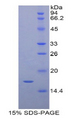 CRBPIV / RBP7 Protein - Recombinant Retinol Binding Protein 7, Cellular By SDS-PAGE
