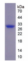 CTGF Protein - Recombinant Connective Tissue Growth Factor By SDS-PAGE