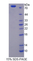PLAT / TPA Protein - Recombinant Plasminogen Activator, Tissue By SDS-PAGE