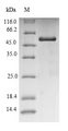 Uricase Protein - (Tris-Glycine gel) Discontinuous SDS-PAGE (reduced) with 5% enrichment gel and 15% separation gel.