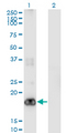 PIGH Antibody - Western Blot analysis of PIGH expression in transfected 293T cell line by PIGH monoclonal antibody (M01), clone 2F8.Lane 1: PIGH transfected lysate (Predicted MW: 21.1 KDa).Lane 2: Non-transfected lysate.