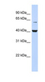 PIGK Antibody - PIGK antibody Western blot of Fetal Pancreas lysate. This image was taken for the unconjugated form of this product. Other forms have not been tested.