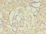 PIGO Antibody - Immunohistochemistry of paraffin-embedded human kidney tissue using antibody at dilution of 1:100.