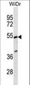 PIGV Antibody - PIGV Antibody western blot of WiDr cell line lysates (35 ug/lane). The PIGV antibody detected the PIGV protein (arrow).