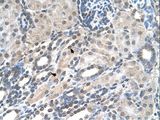 PIGV Antibody - PIGV antibody PIGV(phosphatidylinositol glycan anchor biosynthesis, class V) Antibody was used in IHC to stain formalin-fixed, paraffin-embedded human kidney.  This image was taken for the unconjugated form of this product. Other forms have not been tested.