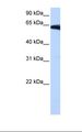 PIGW Antibody - NTERA2 cell lysate. Antibody concentration: 0.5 ug/ml. Gel concentration: 12%.  This image was taken for the unconjugated form of this product. Other forms have not been tested.