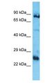 PIK3CB / PI3K Beta Antibody - PIK3CB antibody Western Blot of ACHN. Antibody dilution: 1 ug/ml.  This image was taken for the unconjugated form of this product. Other forms have not been tested.