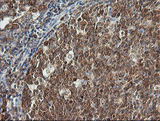 PIK3CG / PI3K Gamma Antibody - IHC of paraffin-embedded Human tonsil using anti-PIK3CG mouse monoclonal antibody.