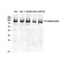PIK3R1 / p85 Alpha Antibody - Western blot of PI 3-kinase p85alpha antibody