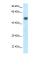 PIK3R1 / p85 Alpha Antibody - PIK3R1 / p85 Alpha antibody Western blot of Mouse Brain lysate. Antibody concentration 1 ug/ml.  This image was taken for the unconjugated form of this product. Other forms have not been tested.