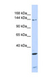PIK3R4 Antibody - PIK3R4 / p150 antibody Western blot of 293T cell lysate. This image was taken for the unconjugated form of this product. Other forms have not been tested.