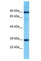 PIK3R6 Antibody - PIK3R6 antibody Western Blot of 721_B. Antibody dilution: 1 ug/ml.  This image was taken for the unconjugated form of this product. Other forms have not been tested.