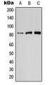 PIK3R6 Antibody - Western blot analysis of PIK3R6 expression in HepG2 (A); mouse brain (B); rat brain (C) whole cell lysates.