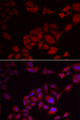 PIKFYVE / PIP5K Antibody - Immunofluorescence analysis of U2OS cells.