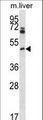 PIM1 / Pim-1 Antibody - Mouse Pim1 Antibody western blot of mouse liver tissue lysates (35 ug/lane). The Pim1 antibody detected the Pim1 protein (arrow).