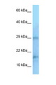 PIN1 Antibody - PIN1 antibody Western blot of Jurkat Cell lysate. Antibody concentration 1 ug/ml.  This image was taken for the unconjugated form of this product. Other forms have not been tested.