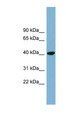 PINX1 Antibody - PINX1 antibody Western blot of COLO205 cell lysate. This image was taken for the unconjugated form of this product. Other forms have not been tested.