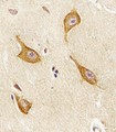 PIP4K2A / PIPK Antibody - Immunohistochemical of paraffin-embedded H. brain section using PIP4K2A antibody diluted at 1:25 dilution. A undiluted biotinylated goat polyvalent antibody was used as the secondary, followed by DAB staining.