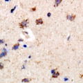 PIP4K2B Antibody - Immunohistochemical analysis of PIP4K2 beta staining in rat brain formalin fixed paraffin embedded tissue section. The section was pre-treated using heat mediated antigen retrieval with sodium citrate buffer (pH 6.0). The section was then incubated with the antibody at room temperature and detected using an HRP conjugated compact polymer system. DAB was used as the chromogen. The section was then counterstained with hematoxylin and mounted with DPX.