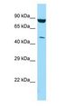 PIP4K2C Antibody - PIP4K2C antibody Western Blot of MCF7.  This image was taken for the unconjugated form of this product. Other forms have not been tested.
