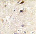 PIP5K1B Antibody - Formalin-fixed and paraffin-embedded human brain tissue reacted with PIP5K1B antibody , which was peroxidase-conjugated to the secondary antibody, followed by DAB staining. This data demonstrates the use of this antibody for immunohistochemistry; clinical relevance has not been evaluated.