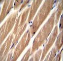 PIP5KL1 Antibody - PIP5KL1 Antibody immunohistochemistry of formalin-fixed and paraffin-embedded human skeletal muscle followed by peroxidase-conjugated secondary antibody and DAB staining.