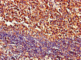 PIPOX / Sarcosine Oxidase Antibody - Immunohistochemistry of paraffin-embedded human tonsil tissue using PIPOX Antibody at dilution of 1:100