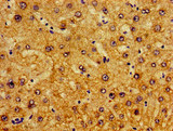Pirin / PIR Antibody - Immunohistochemistry image of paraffin-embedded human liver tissue at a dilution of 1:100