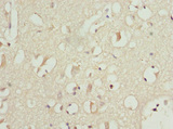PITRM1 / MP1 Antibody - Immunohistochemistry of paraffin-embedded human brain tissue at dilution 1:100