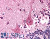 PITX3 Antibody - Anti-PITX3 antibody IHC of human brain, cerebellum. Immunohistochemistry of formalin-fixed, paraffin-embedded tissue after heat-induced antigen retrieval. Antibody concentration 5 ug/ml.  This image was taken for the unconjugated form of this product. Other forms have not been tested.