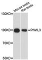PIWIL3 Antibody - Western blot analysis of extracts of various cell lines, using PIWIL3 antibody at 1:3000 dilution. The secondary antibody used was an HRP Goat Anti-Rabbit IgG (H+L) at 1:10000 dilution. Lysates were loaded 25ug per lane and 3% nonfat dry milk in TBST was used for blocking. An ECL Kit was used for detection and the exposure time was 90s.